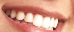 implantes-dentarios-cidade-dutra-1360085919